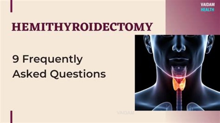 Hemithyroidectomy Cpt Code - How To Discuss